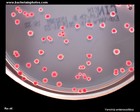 y.enterocolitica on CIN agar
